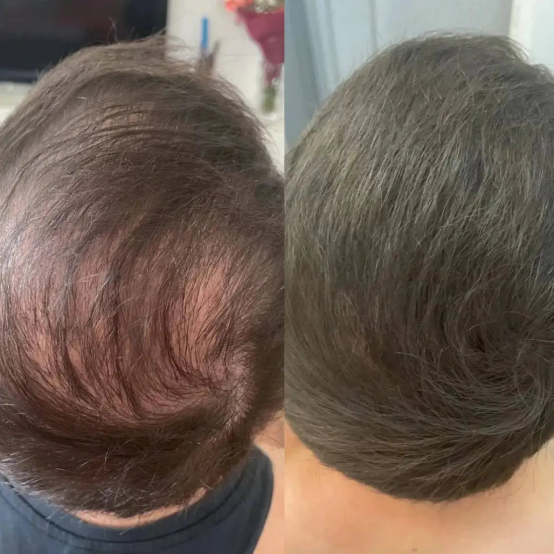 Aura Haarverdichter 2.0