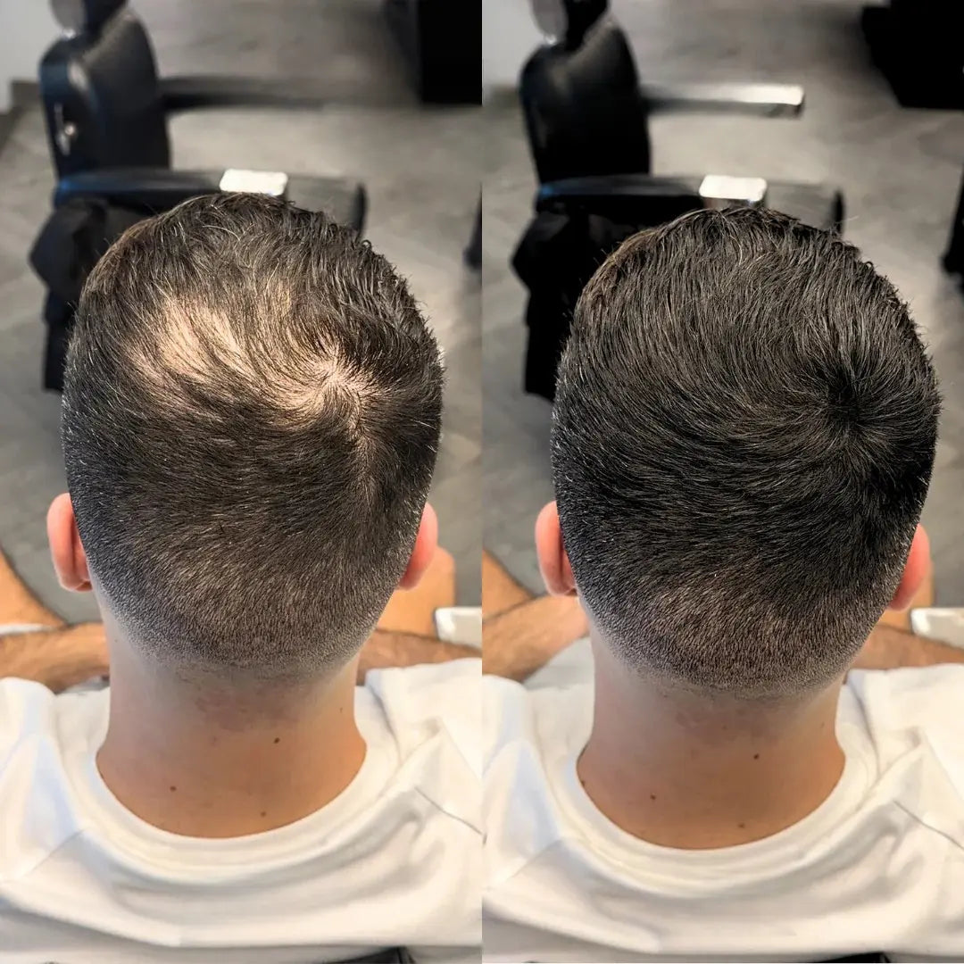 Aura Haarverdichter 2.0