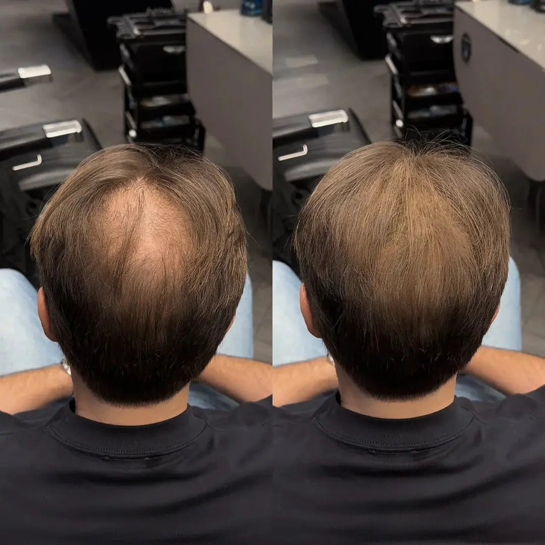 Aura Haarverdichter 2.0